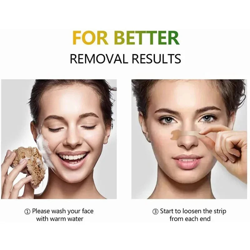 anti snore strips